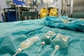 A hospital bed filled with a variety of medical devices and equipment, ready for patient care, Catheters and IV bags in a sterile