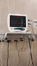 Hospital monitor, shows the vital signs of a person, the cables that connect to the person can be seen