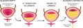 How The Bladder Works. the bladder muscles contract while the sphincter relaxes.