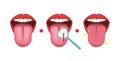 How to clean your tongue vector illustration Halitosis prevention