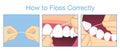How to floss correctly for cleaning teeth Royalty Free Stock Photo