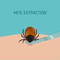 How to remove mite insect parasitic. Encephalitis Tick Warning