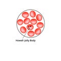 Howell Jolly body. Anemia of the blood. Red cells are erythrocytes in the blood. Vector illustration on isolated Royalty Free Stock Photo