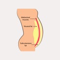 Human abdominal muscles. Ocation of visceral fat stored within abdominal cavity. Medical diagram.