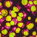 Human acute leukemia cell line nuclei colored in yellow