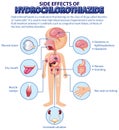 Human anatomy diagram cartoon style of hydrochlorothiazide side effects