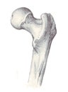 Human anatomy - femur, superior part