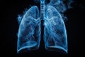 human anatomy lung medical illustration in blue and black, in the style of 3d, simple, black background. Generative AI Royalty Free Stock Photo