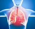 Human anatomy, problems with the respiratory system, severely damaged lungs. Bilateral pneumonia