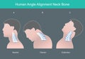 Human angle alignment neck bone. Royalty Free Stock Photo