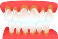 Human anterior teeth