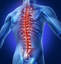 Human-Back-Pain