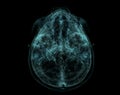 Human Skull, Brain by CT Scan. X-ray Visualization Inside Of Skull. 3D Illustration Render