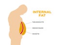 Human belly and abdomen fat layer / subcutaneous and visceral fat Royalty Free Stock Photo