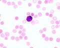 Human blood smear. Basophil Royalty Free Stock Photo