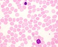 Human blood smear. Lymphocyte and erythroblast Royalty Free Stock Photo