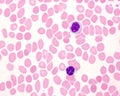 Human blood smear. Lymphocyte and monocyte