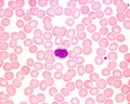 Human blood smear. Monocyte Royalty Free Stock Photo