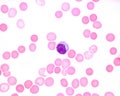 Human blood smear. Monocyte