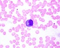 Human blood smear. Monocyte