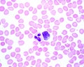 Human blood smear. Neutrophil and monocyte