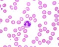 Human blood smear. Neutrophil