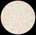 Human blood under the microscope (Blood Smear Human)