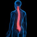 Human Body Joint Bone Pains (Spinal Cord)