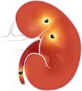 Human body view of kidneys. Section of the kidney. Kidney stones