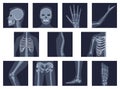 Human bones orthopedic and skeleton icon set, bone x-ray image of human joints, anatomy skeleton flat design vector Royalty Free Stock Photo