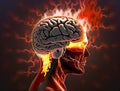 Human brain burning head headache illustration, strong bursting pain in head region Royalty Free Stock Photo