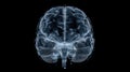 Human brain in a ct scan created with Generative AI. Scanning with x-rays. Computer tomography. Royalty Free Stock Photo