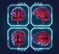 Human brain with futuristic hud interface background.