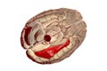 Human brain with highlighted fusiform gyrus