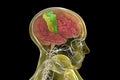 Human brain with highlighted precentral and postcentral gyri