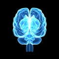 Human Brain posterior view Royalty Free Stock Photo