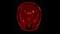 Human Brain Scan. Mri Brain Scan. Computed tomography of the human brain.