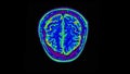 Human Brain Scan. Mri Brain Scan. Computed tomography of the human brain.