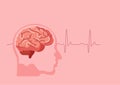 Human brain stroke illustration