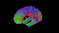 The human brain white matter tracts_Corpus Callosum (CC) Royalty Free Stock Photo