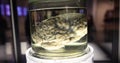 Human brains in formaldehyde jar lab