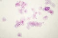 Light photomicrograph of buccal smear