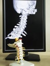 Cervical spine model and MRI picture Royalty Free Stock Photo