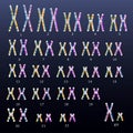 Human chromosome kariothype. Vector illustration. Royalty Free Stock Photo