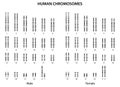 Human chromosomes (human normal karyotype). Royalty Free Stock Photo