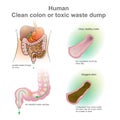 Human Clean colon or toxic waste dump. Vector, Illustration.