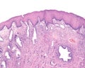 Human endocervix. Squamous metaplasia