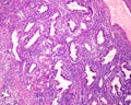 Human endometrium. Secretory phase