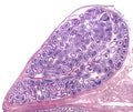 Human epididymis