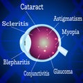 Human Eye diseases 2